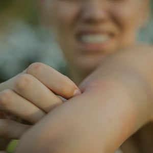 What does insect sting allergy look like?